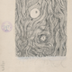 Tumor cells of the covering membranes of the brain, 1890